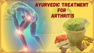 Ayurvedic Treatment for Arthritis 1024x576