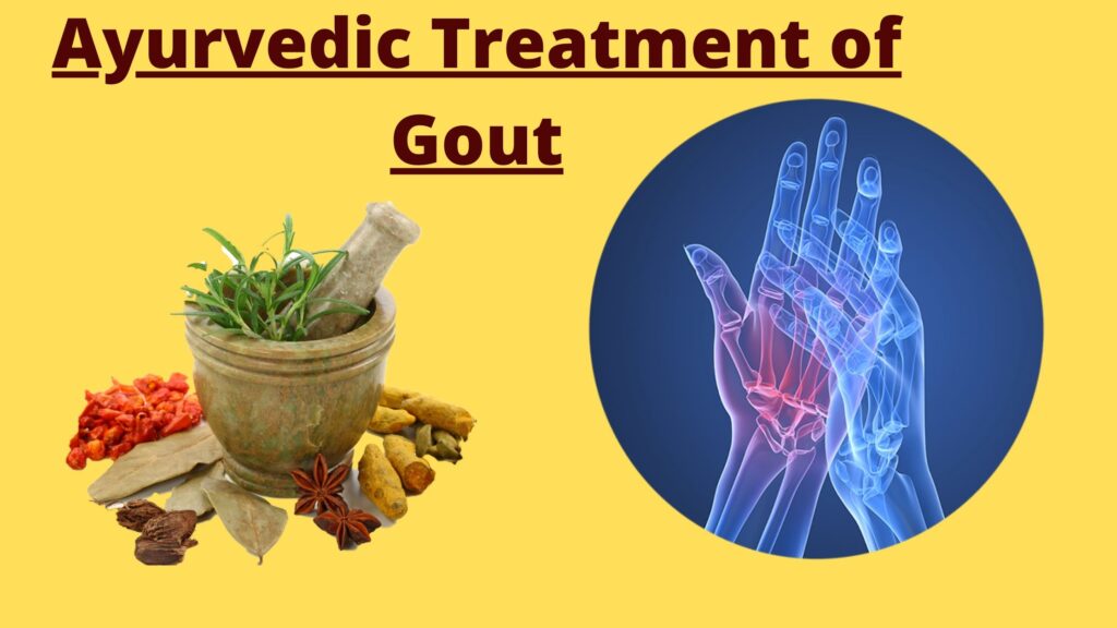 Ayurvedic Treatment of Gout