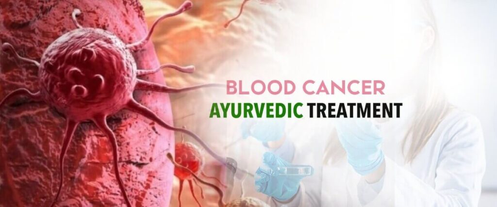 Blood Cancer Treatment