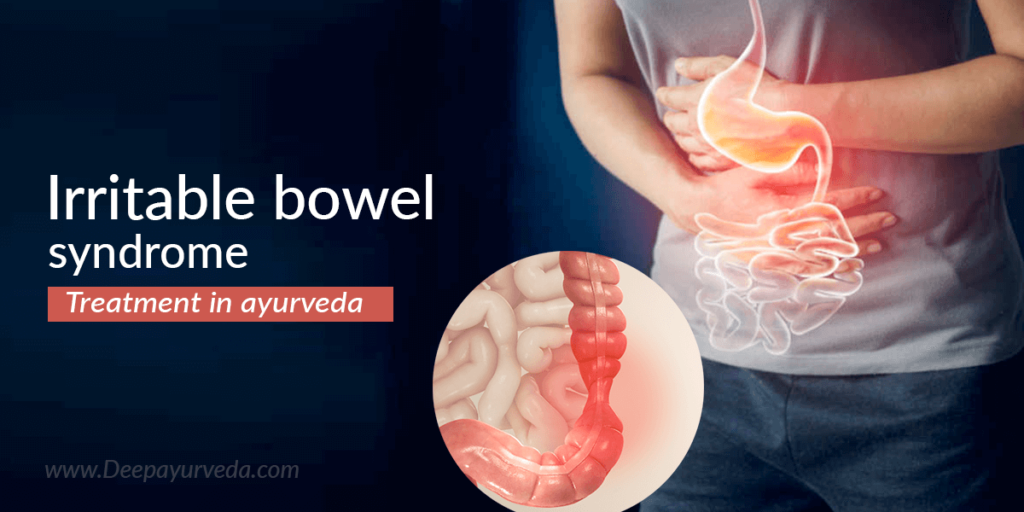 Irritable Bowel Syndrome